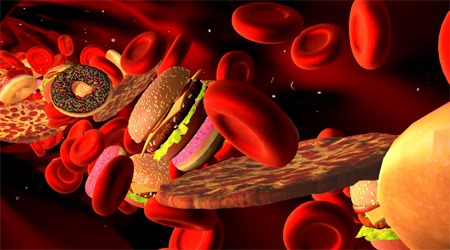 راه های درمان چربی و کلسترول خون