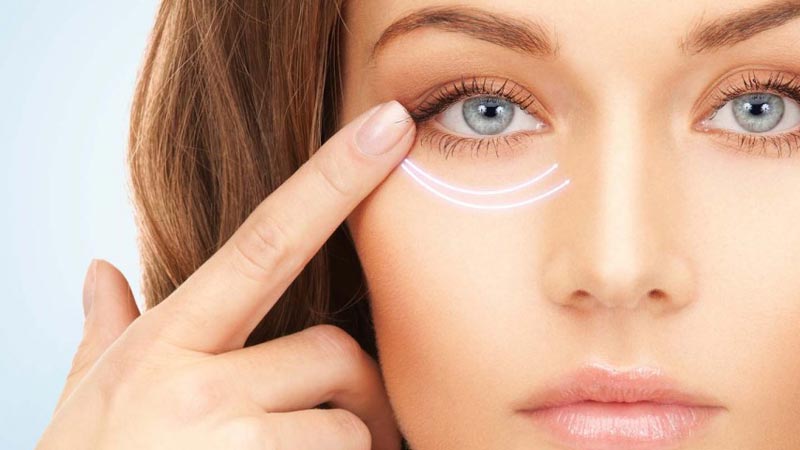 چروک دور چشم