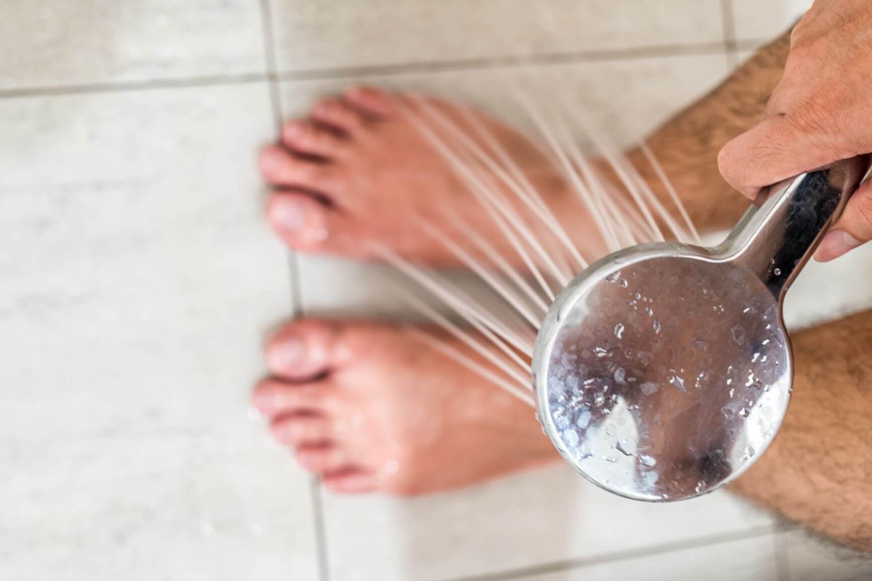 درمان عفونت قارچی پوست